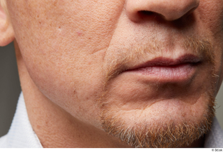 HD Face Skin Steve Q bearded chin face scar skin…